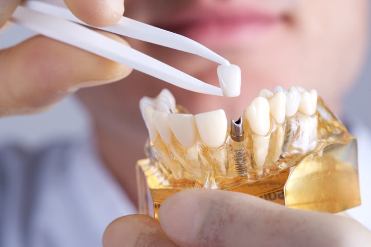 Dental Marketing Sugar Land