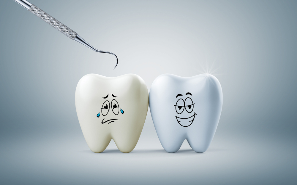 Invisalign treatment